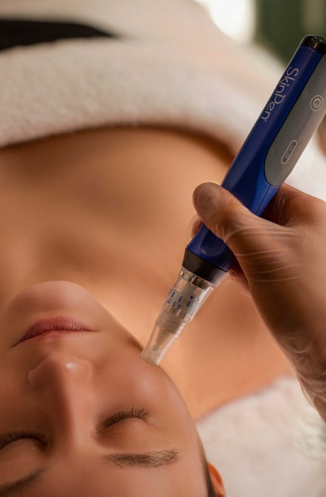SkinPen microneedling device used during a facial treatment at Sous La Face